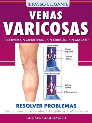 cover image of Venas Varicosas--Solución definitiva
